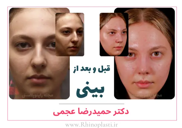 تصاویر گالری بیماران دکتر حمیدرضا عجمی