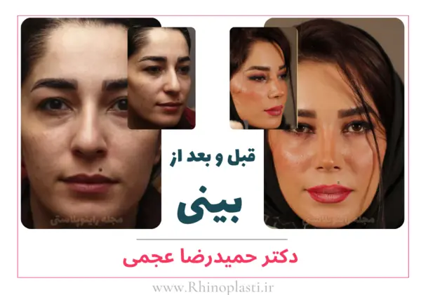تصاویر گالری بیماران دکتر حمیدرضا عجمی