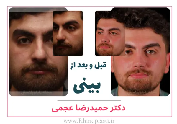 تصاویر گالری بیماران دکتر حمیدرضا عجمی