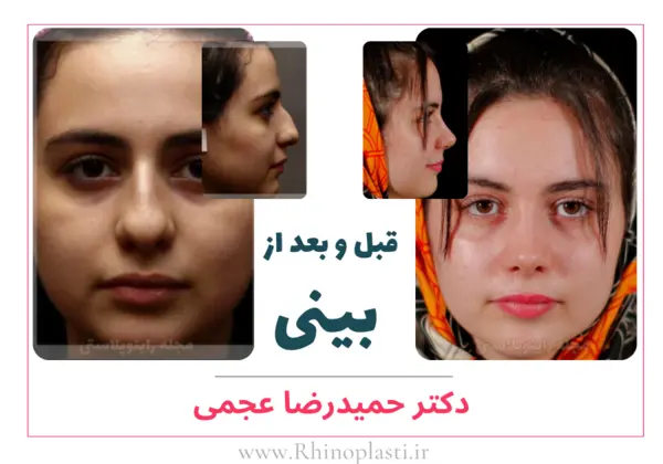 تصاویر گالری بیماران دکتر حمیدرضا عجمی