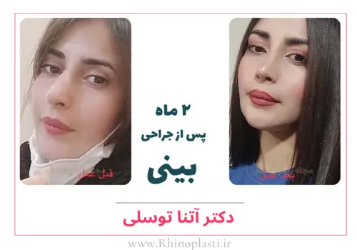 تصاویر جراحی دکتر آتنا توسلی