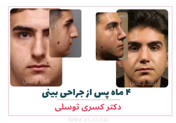 تصاویر گالری بیماران دکتر کسری توسلی