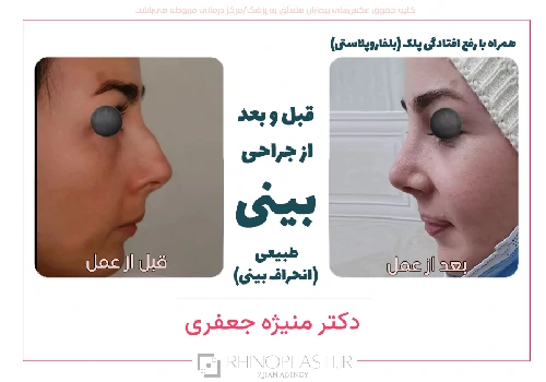 تصاویر جراحی دکتر منیژه جعفری