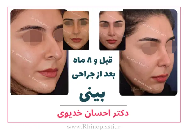 تصاویر گالری بیماران دکتر احسان خدیوی