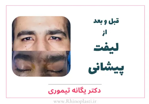 تصاویر جراحی دکتر یگانه تیموری