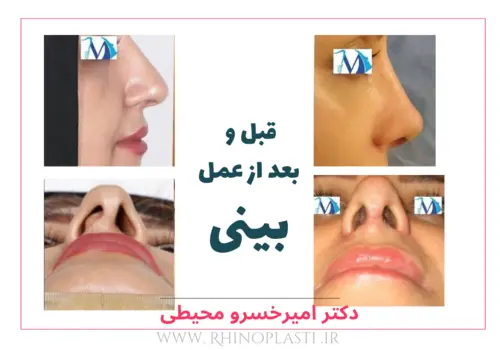 تصاویر جراحی دکتر امیرخسرو محیطی