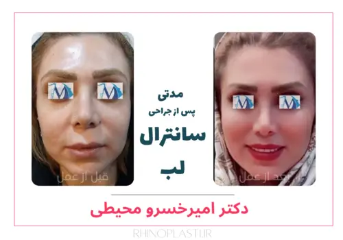 تصاویر جراحی دکتر امیرخسرو محیطی