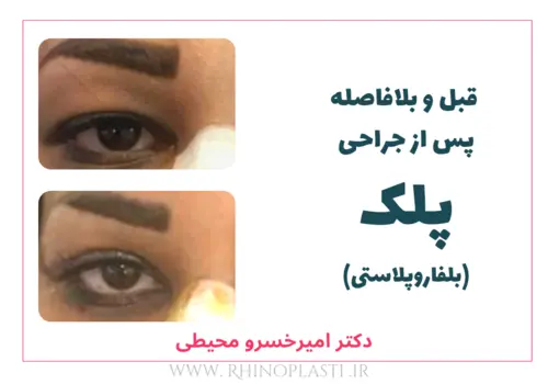 تصاویر جراحی دکتر امیرخسرو محیطی