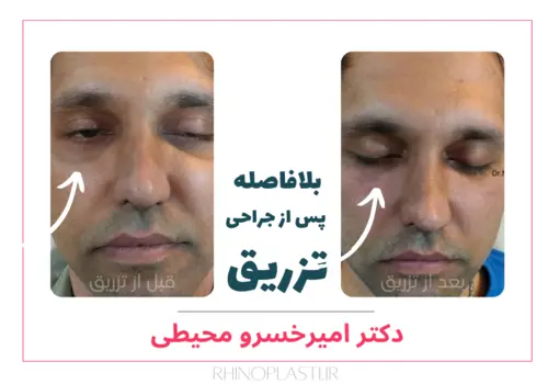 تصاویر جراحی دکتر امیرخسرو محیطی