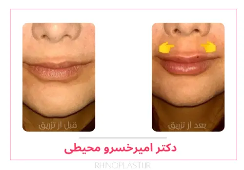 تصاویر جراحی دکتر امیرخسرو محیطی
