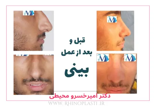 تصاویر جراحی دکتر امیرخسرو محیطی