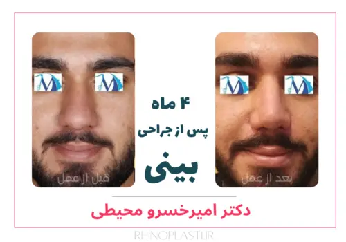تصاویر جراحی دکتر امیرخسرو محیطی
