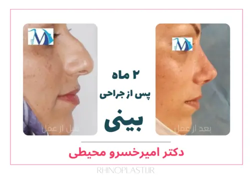 تصاویر جراحی دکتر امیرخسرو محیطی