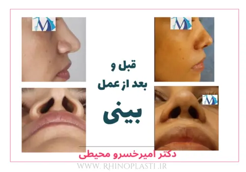 تصاویر جراحی دکتر امیرخسرو محیطی