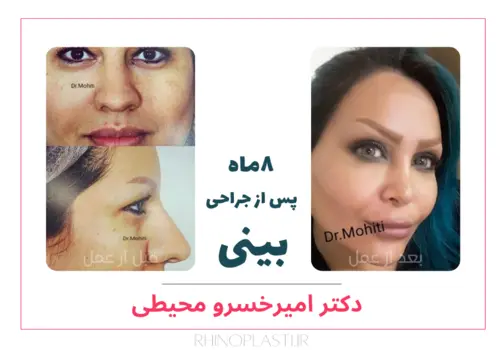 تصاویر جراحی دکتر امیرخسرو محیطی