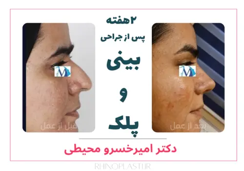 تصاویر جراحی دکتر امیرخسرو محیطی