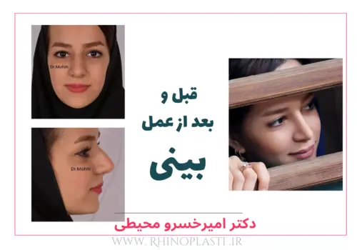 تصاویر جراحی دکتر امیرخسرو محیطی