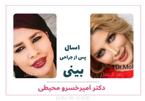 تصاویر جراحی دکتر امیرخسرو محیطی
