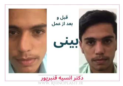تصاویر جراحی دکتر انسیه قنبرپور