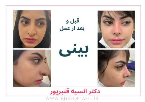 تصاویر جراحی دکتر انسیه قنبرپور