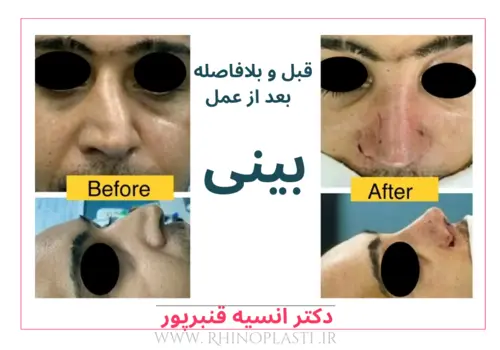 تصاویر جراحی دکتر انسیه قنبرپور