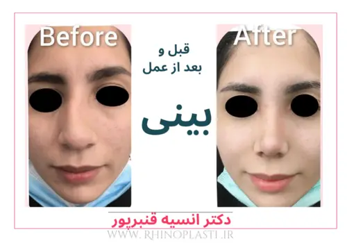 تصاویر جراحی دکتر انسیه قنبرپور