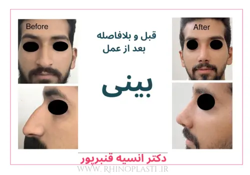 تصاویر جراحی دکتر انسیه قنبرپور