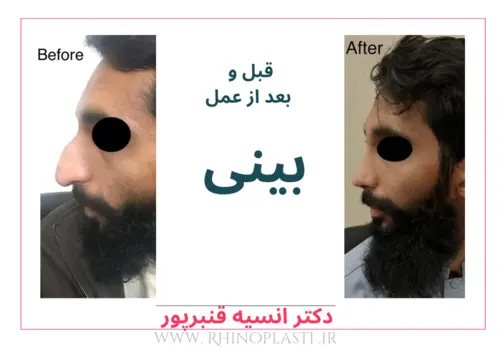 تصاویر جراحی دکتر انسیه قنبرپور