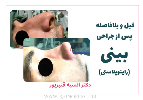 تصاویر گالری بیماران دکتر انسیه قنبرپور