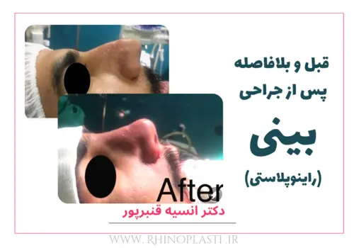 تصاویر گالری بیماران دکتر انسیه قنبرپور