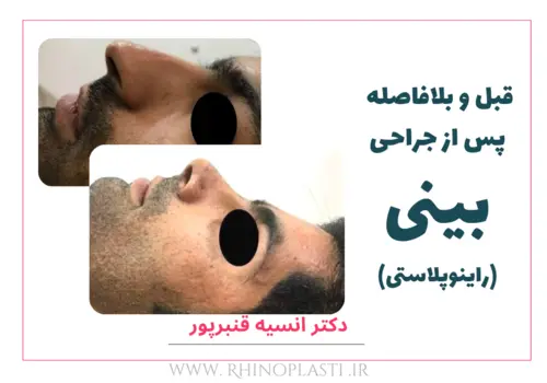 تصاویر گالری بیماران دکتر انسیه قنبرپور
