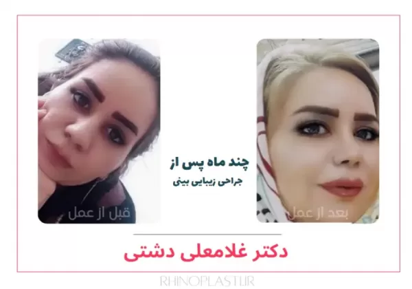 تصاویر جراحی دکتر غلامعلی دشتی
