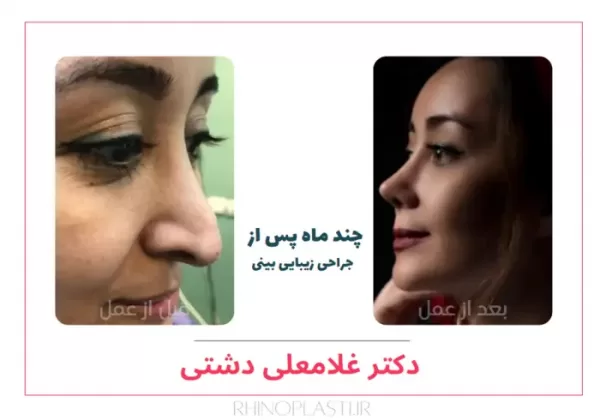 تصاویر جراحی دکتر غلامعلی دشتی
