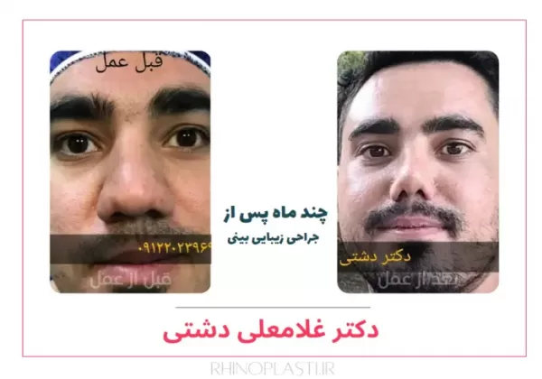 تصاویر جراحی دکتر غلامعلی دشتی