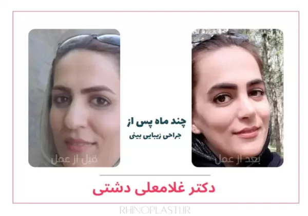 تصاویر جراحی دکتر غلامعلی دشتی
