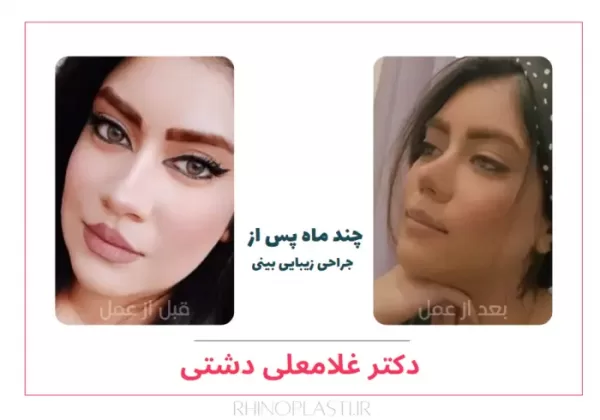 تصاویر جراحی دکتر غلامعلی دشتی