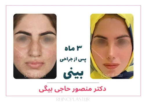 تصاویر جراحی دکتر منصور حاجی بیگی