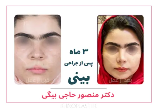 تصاویر جراحی دکتر منصور حاجی بیگی