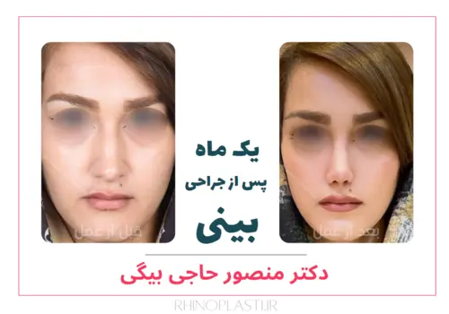 تصاویر جراحی دکتر منصور حاجی بیگی