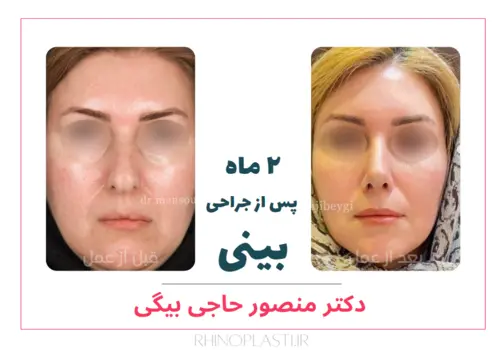 تصاویر جراحی دکتر منصور حاجی بیگی