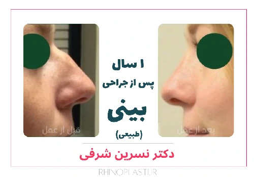 تصاویر جراحی دکتر نسرین شرفی
