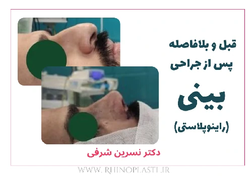 تصاویر جراحی دکتر نسرین شرفی