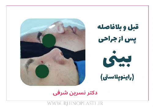 تصاویر گالری بیماران دکتر نسرین شرفی
