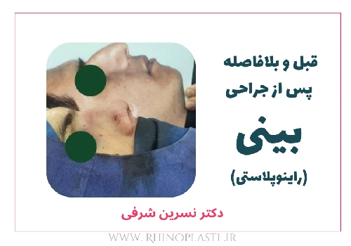 تصاویر گالری بیماران دکتر نسرین شرفی