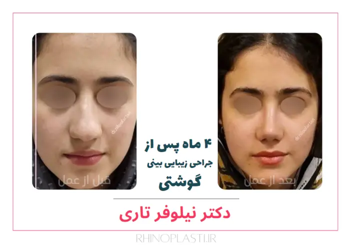 تصاویر جراحی دکتر نیلوفر تاری
