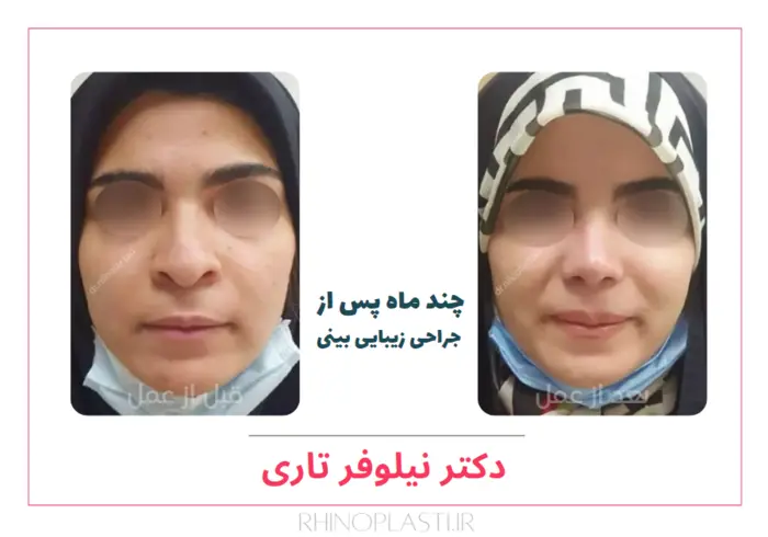 تصاویر جراحی دکتر نیلوفر تاری
