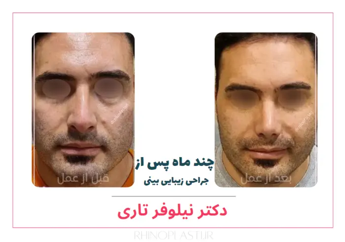 تصاویر جراحی دکتر نیلوفر تاری