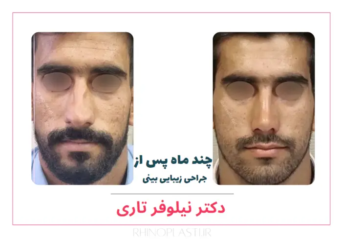 تصاویر جراحی دکتر نیلوفر تاری