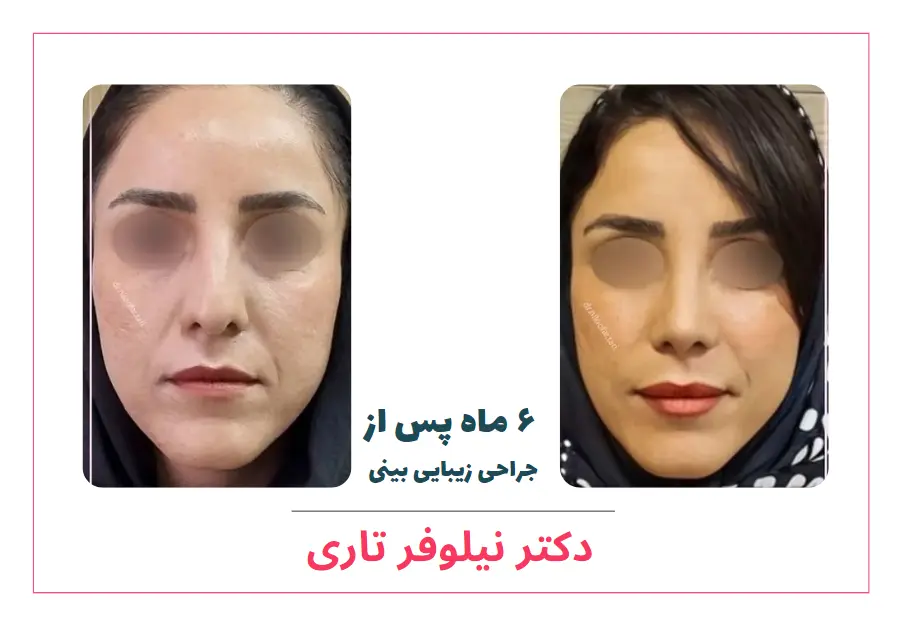 تصاویر جراحی دکتر نیلوفر تاری