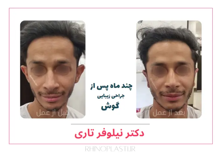 تصاویر جراحی دکتر نیلوفر تاری